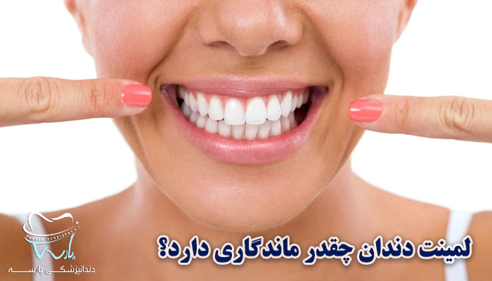 ماندگاری لمینت دندان چقدر است؟