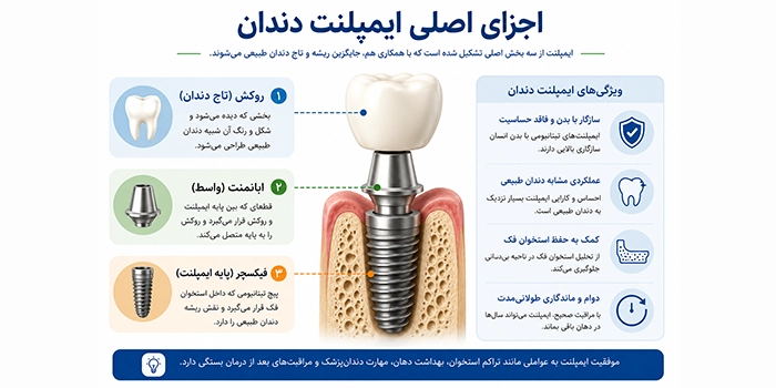 ایمپلنت دندان در کرج؛ راهنمای کامل کاشت، هزینه و مراقبتهای بعد از ایمپلنت