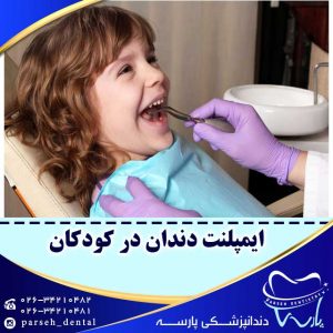 ایمپلنت-دندان-کودکان