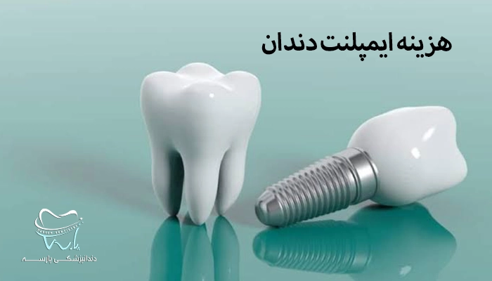 هزینه ایمپلنت دندان در کرج در سال 1405 چقدر است؟