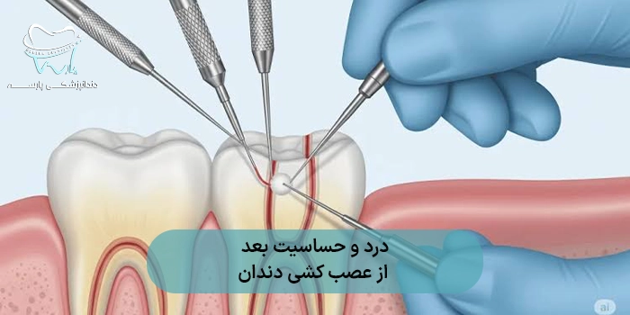 درد و حساسیت بعد از عصب کشی دندان تا چند روز طبیعی است؟