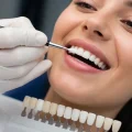 کامپوزیت دندان در کرج؛ بهترین کلینیک را چگونه انتخاب کنیم؟